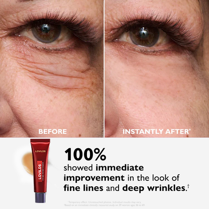 🔥  Last 3 Hours 50% OFF  ✨ BUY 1 GET 1 FREE🔥Eye Bag Eraser — Instantly Refreshes, Firms & Smooths for a Youthful Look That Lasts 8 Hours