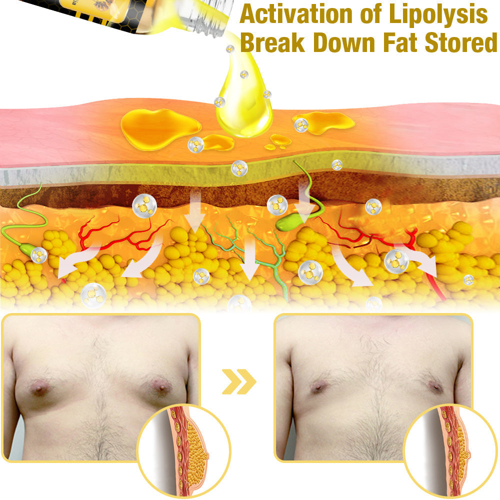 BBOJI™ MenTherm Bee Venom Gynecomastia Heating Oil