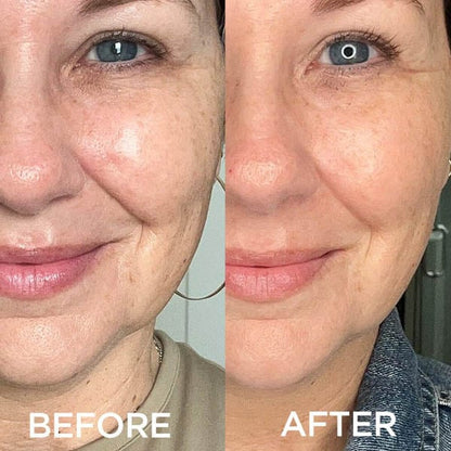🎉🔥Mother's Day Promotion 49% OFF - 🔥Anti-aging Spot-lightening Essence