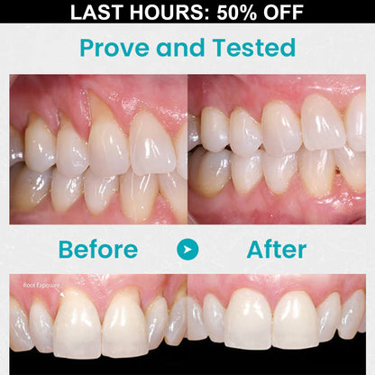 🎄Christmas Pre-sale 50% OFF-Seurico™  Gum Shield Therapy Gel