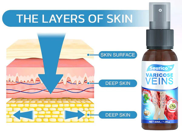 Seurico™ Varicose Veins Spray