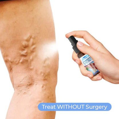 Seurico™ Varicose Veins Spray