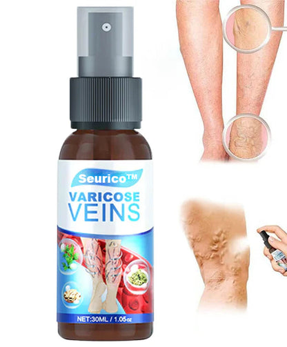Seurico™ Varicose Veins Spray