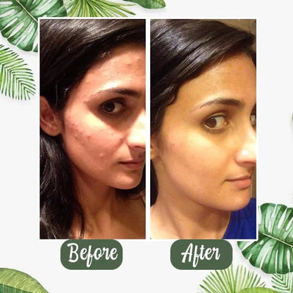 🔥Hot Sale 49% OFF - Deep Cleanse Green Tea Mask