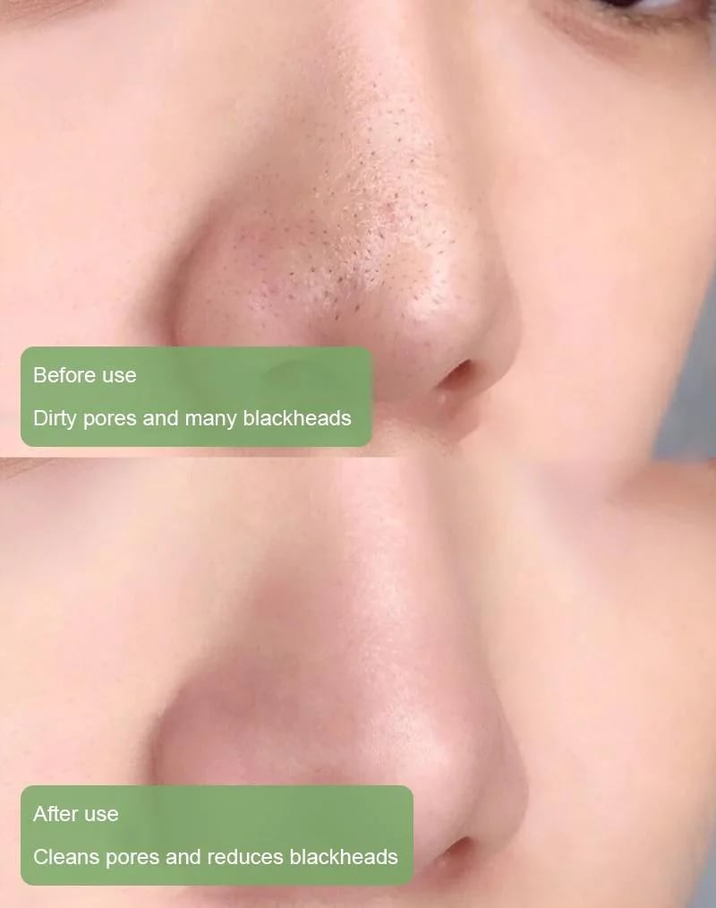 🔥Hot Sale 49% OFF - Deep Cleanse Green Tea Mask