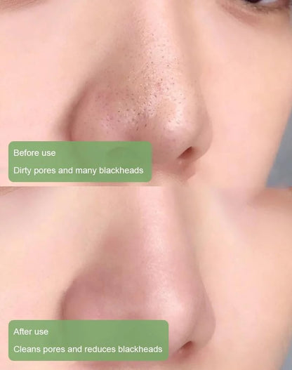 🔥Hot Sale 49% OFF - Deep Cleanse Green Tea Mask