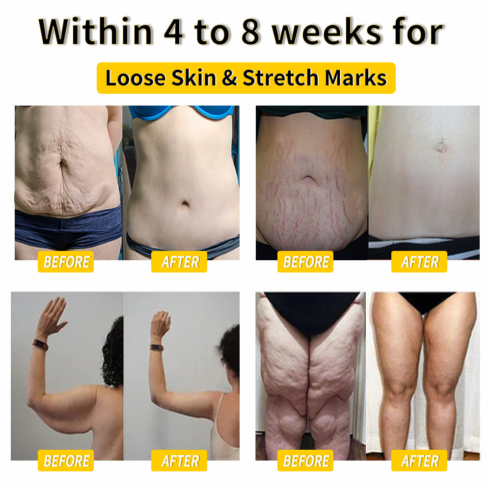 Cvreoz™ Bee Venom Lymphatic Drainage & Skin Firming Slimming Cream