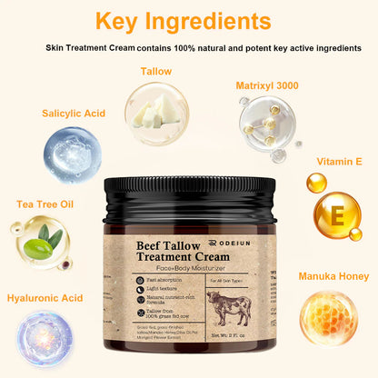👨‍⚕️[Official Store]ODEIUN All-Purpose Beef Tallow Repair Cream（复制）