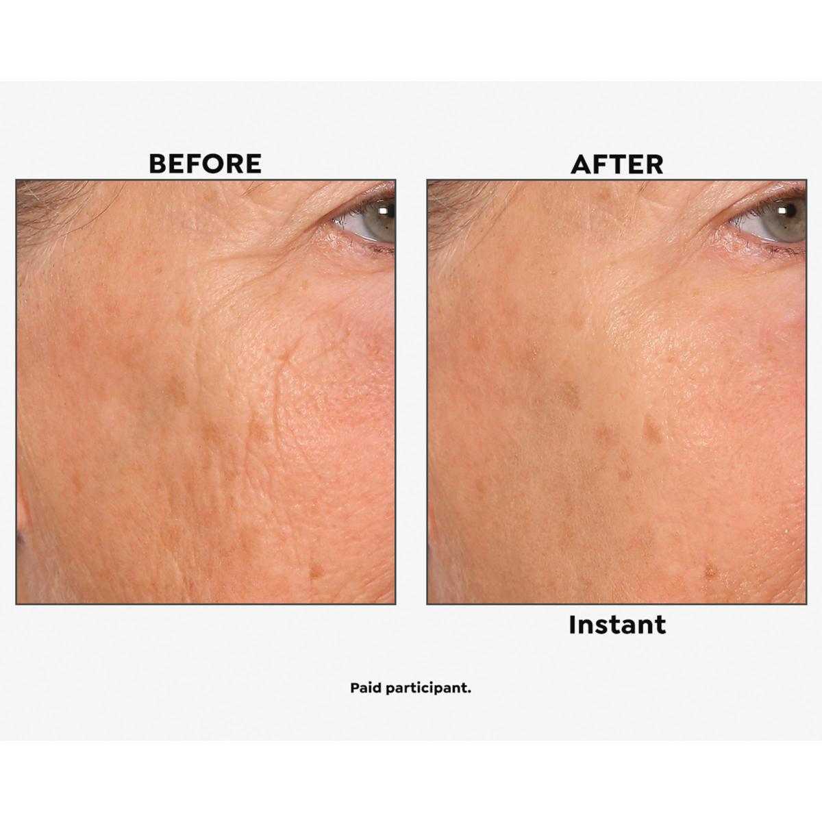 Flysmus™ Skip the Line Instant Wrinkle Eraser