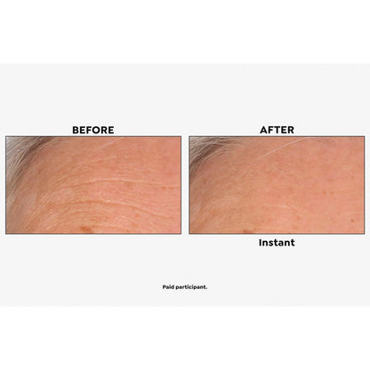 Flysmus™ Skip the Line Instant Wrinkle Eraser