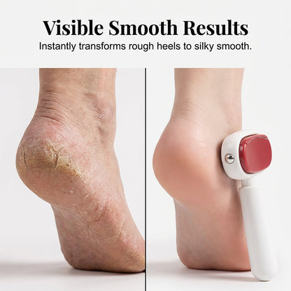 📢📢 50% OFF!! ⏰Double-Sided Foot File for Callus Removal