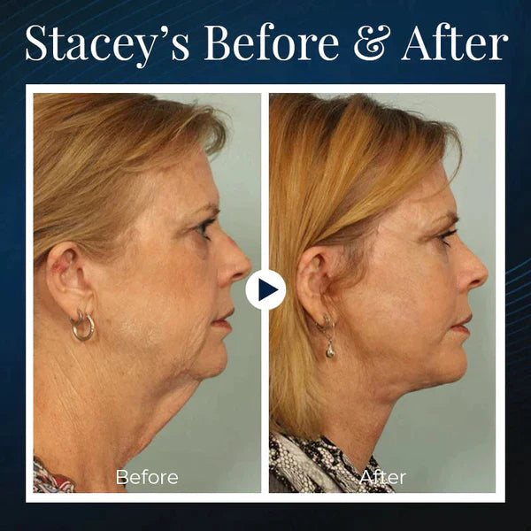 🔥Seurico™ BeautyRestSleeping V-Face Beauty Device