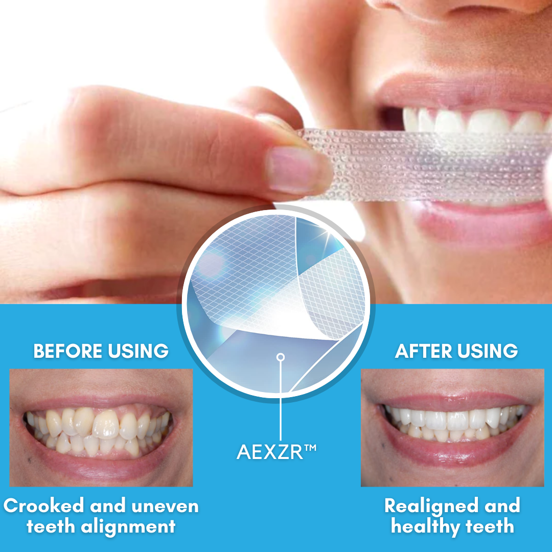 Seurico™ Teeth Aligner Strips