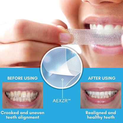 Seurico™ Teeth Aligner Strips