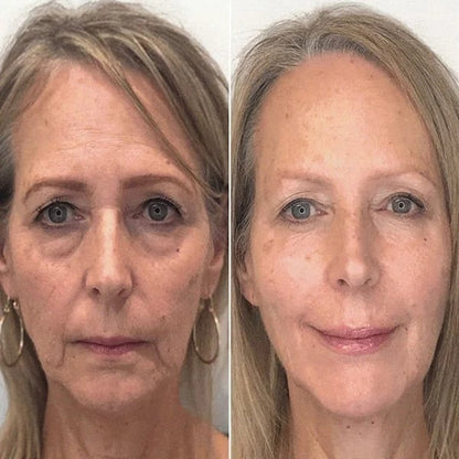 Last Day Promotion 49% OFF - 🔥Seurico™ Face Serum