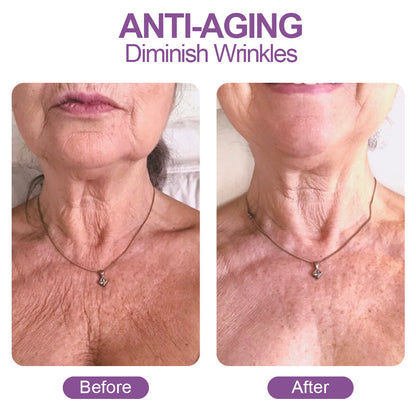 CollaNeck™ Hydrolyzed Collagen Water Cream