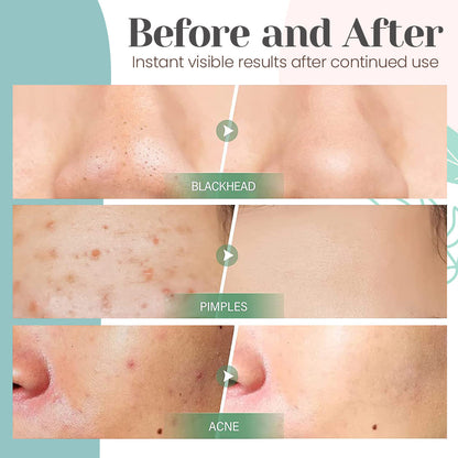Seurico™ Green Tea Cleansing Mask Bar（Limited Time Discount 🔥 Last Day）