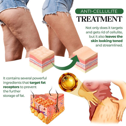 Seurico™Cellulite Targeting Patches🌿