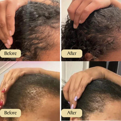 Seurico™ - veganic hair growth oil