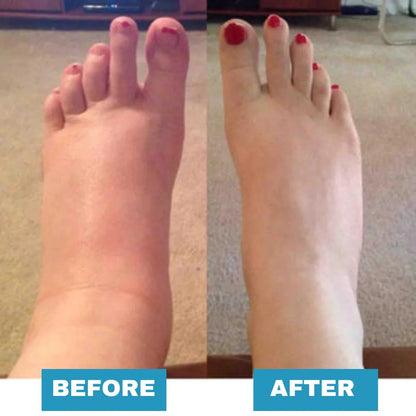 🔥【Clearance Sale】 Foot Massager - For Lasting Foot Pain Relief