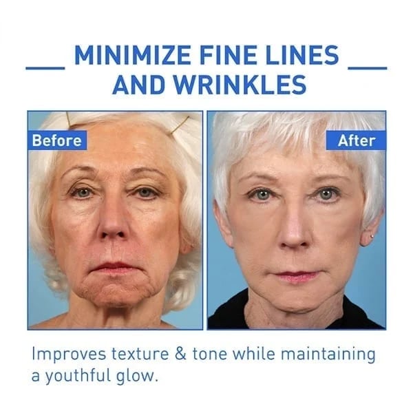 Last Day Promotion 49% OFF - 🔥Seurico™ Face Serum