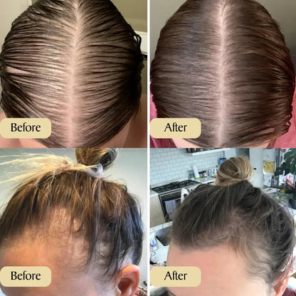 Seurico™ - veganic hair growth oil