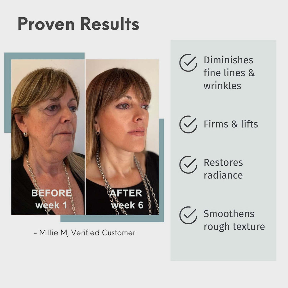 🔥Limited-time 70% discount🔥 [PH]Iller Peptide Anti-Aging Face Serum