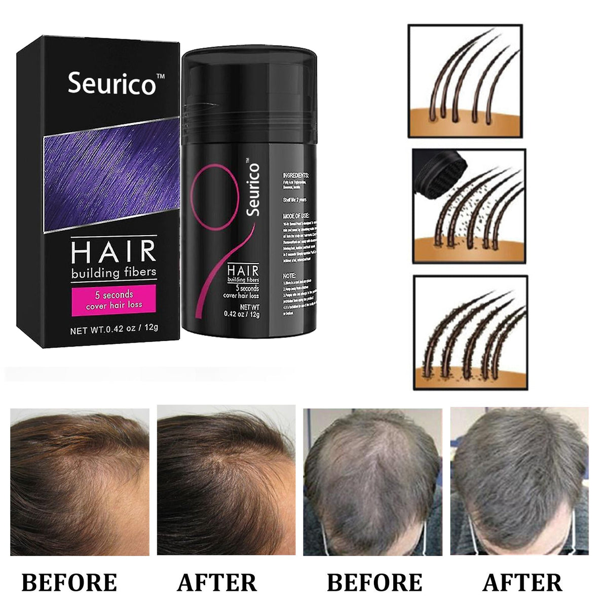 LAST DAY 40% Off -Seurico™ hair fiber powder-Effective hair supplement🔥🌈BUY MORE SAVE MORE!