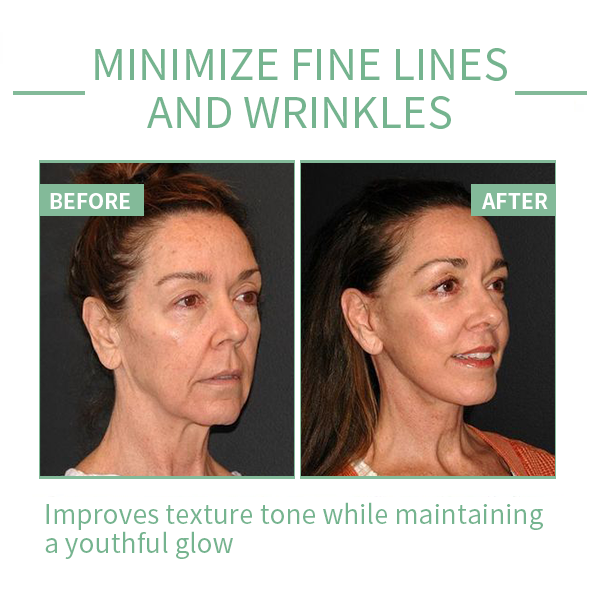 🔥Limited-time 70% discount🔥 [PH]Iller Peptide Anti-Aging Face Serum