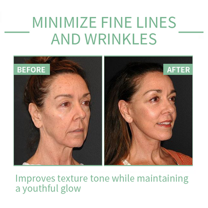 🔥Limited-time 70% discount🔥 [PH]Iller Peptide Anti-Aging Face Serum