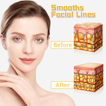 Seurico™ UltraRenew PRO Ultrasonic Facelift Device