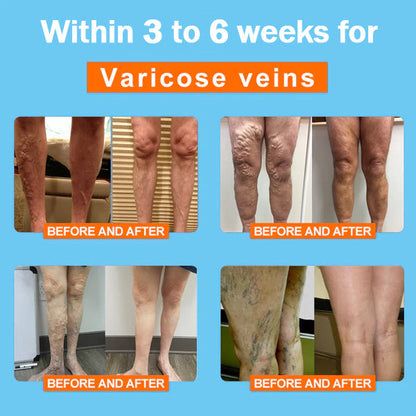 Seurico™ Ionic Correction Lymphatic Detoxification Long Tube Silk Stockings (⭐⭐⭐⭐⭐limited time offer, lasts 30 minutes)