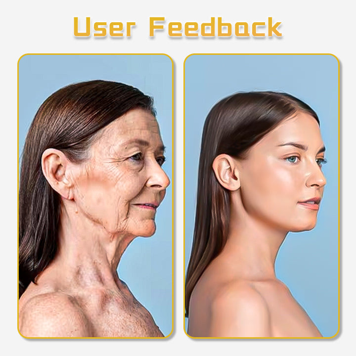 Seurico™ UltraRenew PRO Ultrasonic Facelift Device