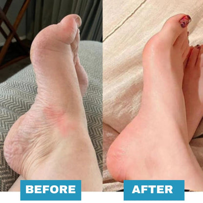 🔥【Clearance Sale】 Foot Massager - For Lasting Foot Pain Relief