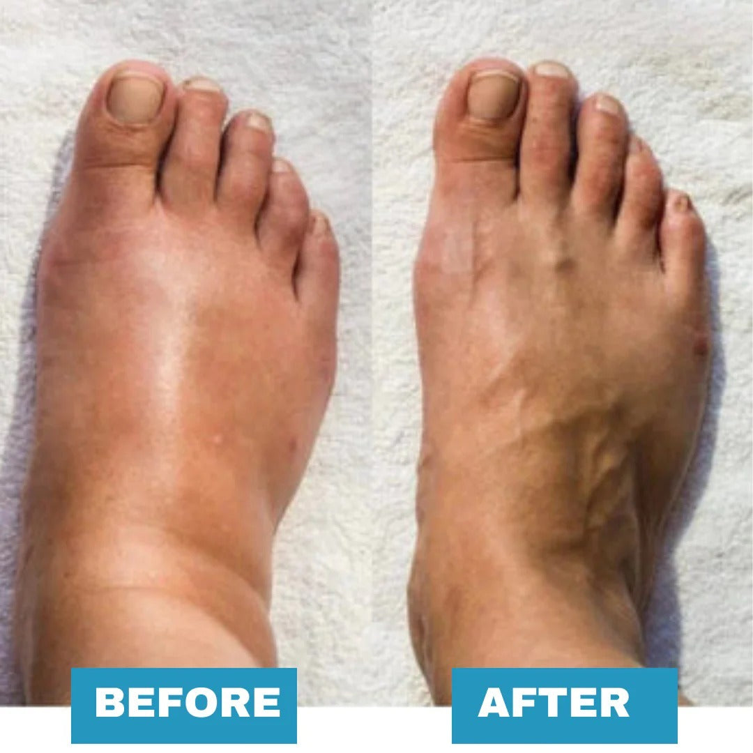 🔥【Clearance Sale】 Foot Massager - For Lasting Foot Pain Relief