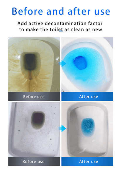 🔥   49% OFF💕SINK & DRAIN CLEANER🔥
