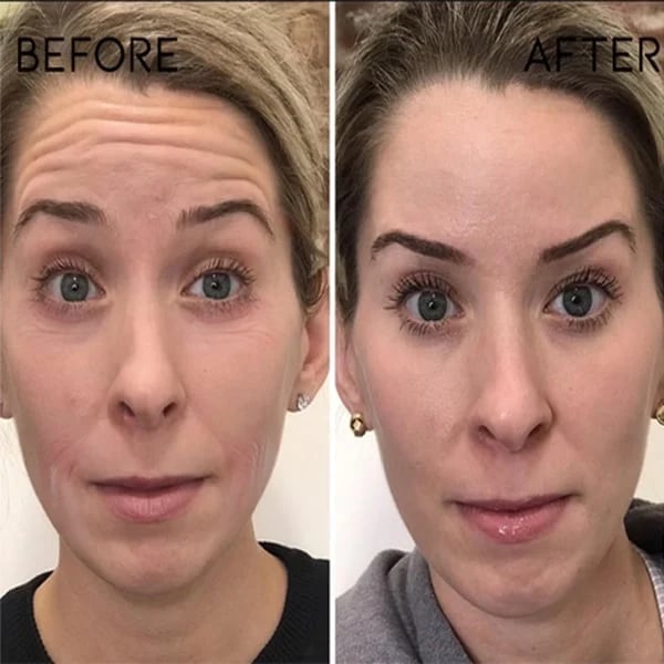 Last Day Promotion 49% OFF - 🔥Seurico™ Face Serum