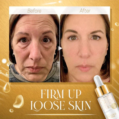 Last Day Special Sale 70% OFF-24K GOLD COLLAGEN BOOSTER SERUM
