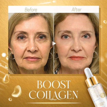 Last Day Special Sale 70% OFF-24K GOLD COLLAGEN BOOSTER SERUM