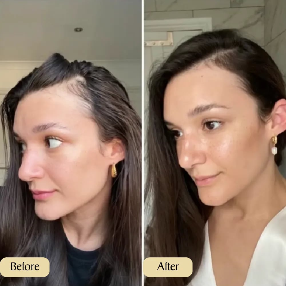 Seurico™ - veganic hair growth oil