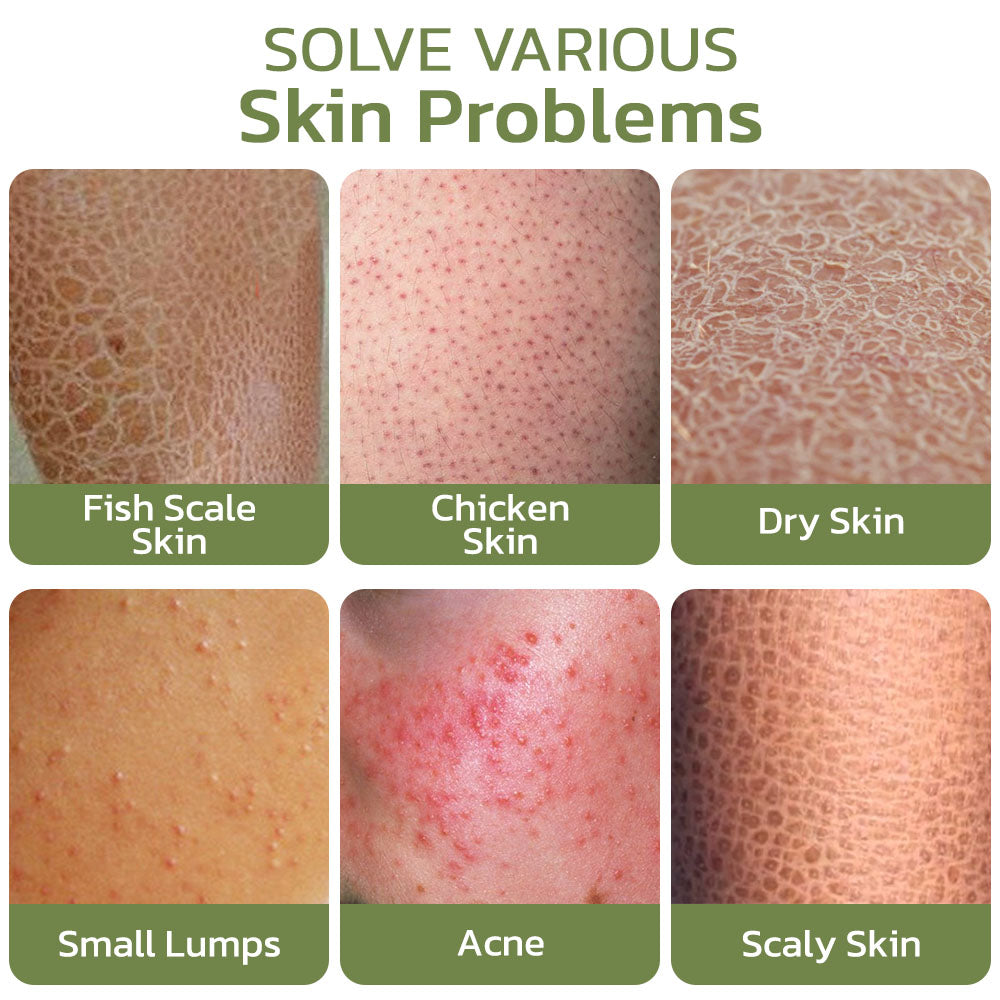 Seurico™ Deep Cleansing Smoothing Cream