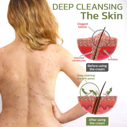 Seurico™ Deep Cleansing Smoothing Cream