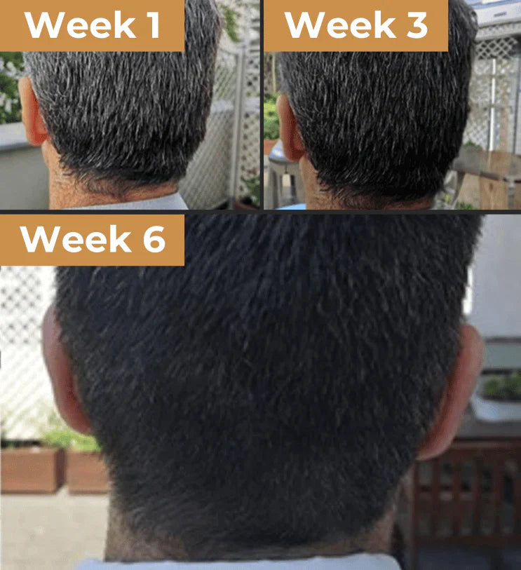 Seurico™GrayAway Magic - Hair Darkening Bar Shampoo