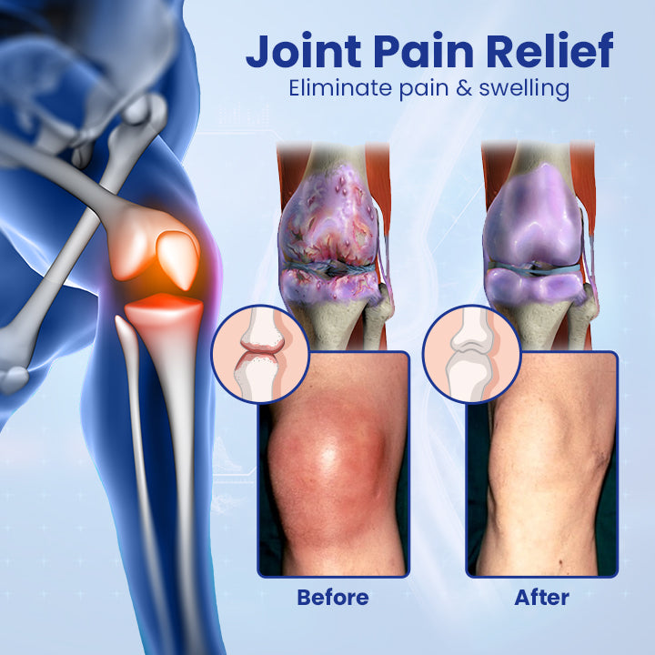 Ceoerty™ Regenerative Bone Repair Gel Roller