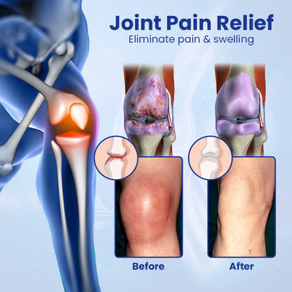 Ceoerty™ Regenerative Bone Repair Gel Roller