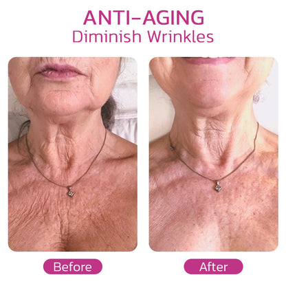 RejuvaNeck™ Hydrating Collagen Neck Cream