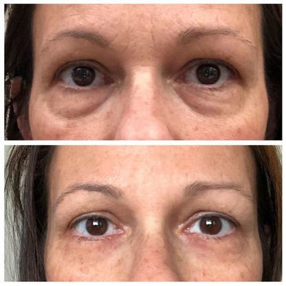 OSUFI™ Korea Eye Firming Serum
