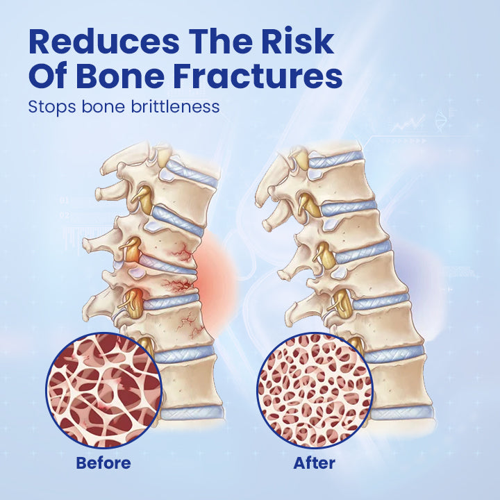 Ceoerty™ Regenerative Bone Repair Gel Roller