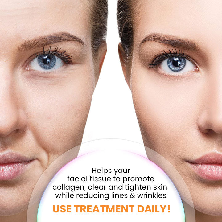 🔥Seurico™ Korea Soluble Anti-Wrinkle Collagen Mask