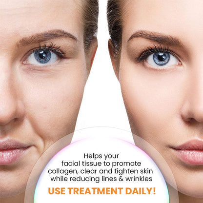 🔥Seurico™ Korea Soluble Anti-Wrinkle Collagen Mask